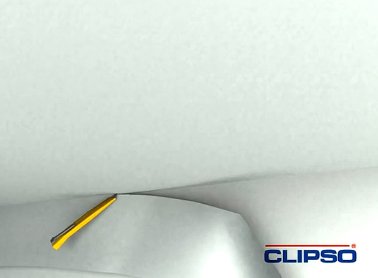 Обрезка излишков полотна